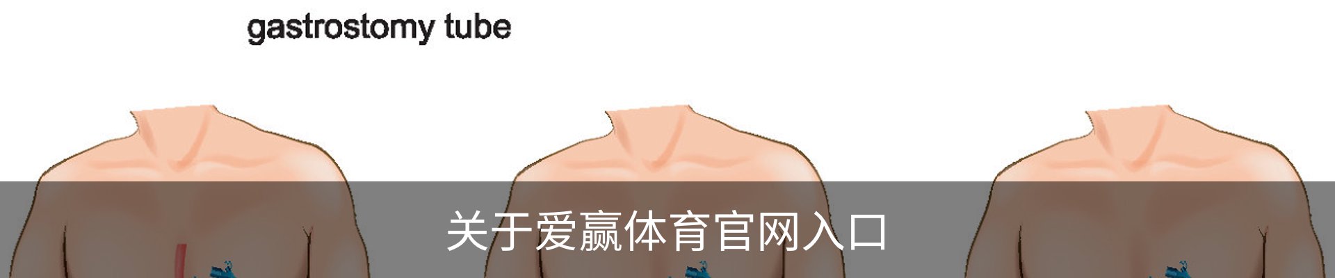 关于爱赢体育官网入口